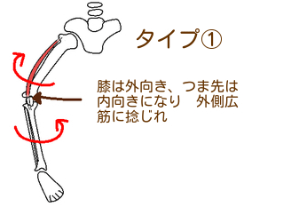 お皿の向きと膝関節の捻じれ