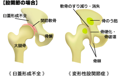 一般的な股関節痛の考え方