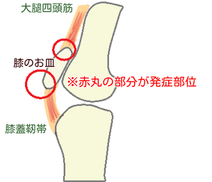 スポーツをしている１０代の子は要注意です！