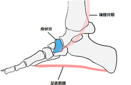 有痛性外脛骨