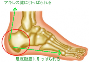 きむら整体院のセバー病への考え方